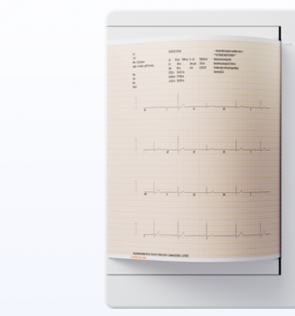 ekg-papier-210-x-250-mm